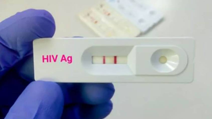 NDA Warns of Expired HIV Test Kits on Sale in the City