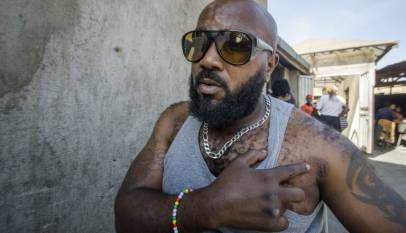 Eddie Mutwe Makes Court Appearance in Pain, Charged with Robbery and Assault