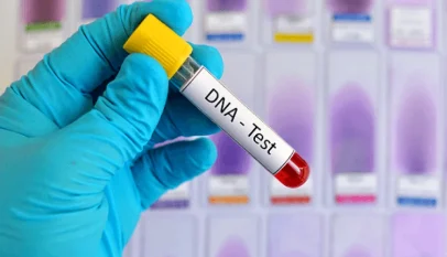Ministry Advises Men to Avoid Mental Anguish of DNA tests following 98% Negative Outcome