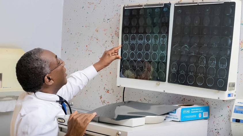 WHO Raises Alarm over Limited Access to Treatment for Brain Illness