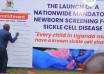 Ministry of Health Launches Mandatory Sickle Cell Testing for Babies