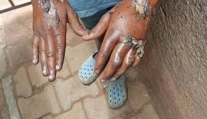 Police Link Child Torture Case to Persistent Domestic Abuse Trends