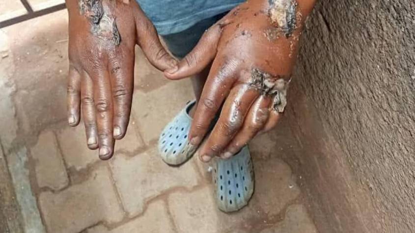 Police Link Child Torture Case to Persistent Domestic Abuse Trends