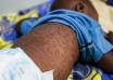 Almost Half of African Countries Battling Measles Outbreaks