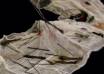Surgeons Take 8 Hours to Extract 50 Needles inside Tortured Boy's Stomach