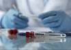 WHO Supports Nigeria After First Ebola Bundibugyo Case Detected